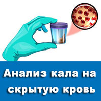 Анализ кала на скрытую кровь: показания и правила подготовки