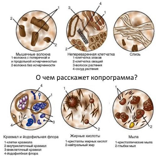 Что показывает копрологическое исследование кала Что показывает копрограмма
