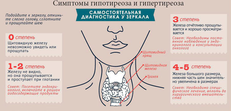 Диагностика гипертиреоза Симптомы и степени проявления гипертиреоза