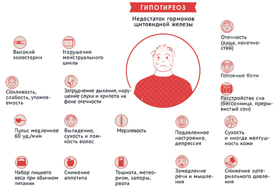 Симптомы характерные для гипотиреоза Клинические проявления гипотиреоза