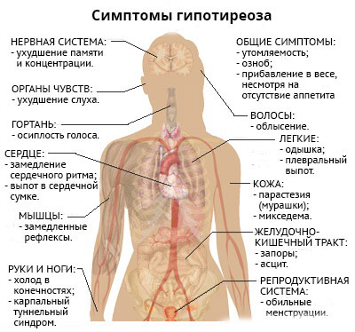 Как проявляются симптомы гипотиреоза у женщин Какие симптомы наблдаются при снижении функции щитовидной железы