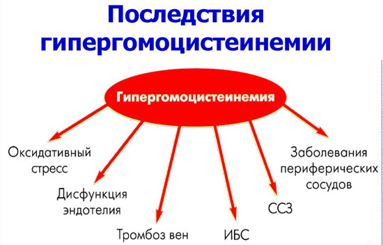 К чему приводит гипергомоцистеинемия Последствия гипергомоцистеинемии