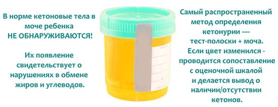 Кетоновые тела в моче: норма, причины повышения