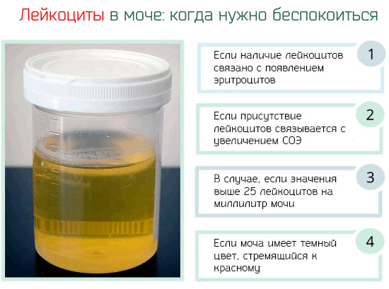 О чем говорят повышенные лейкоциты в моче Когда опасны повышенные лейкоциты в моче