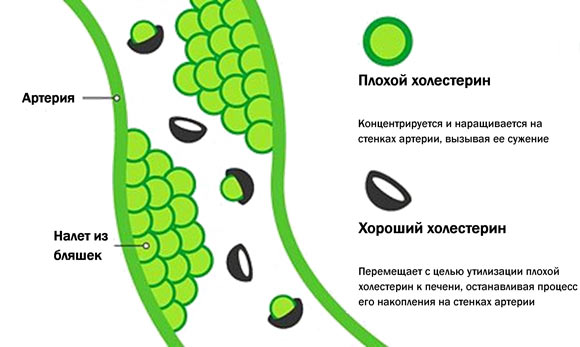 отличие плохого от хорошего холестирина отличие плохого от хорошего холестирина