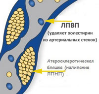 ЛПВП, что это такое?