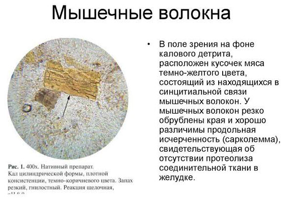 Что значат мышечные волокна в кале О чем говорит наличие мышечных волокон в кале при проведении анализа
