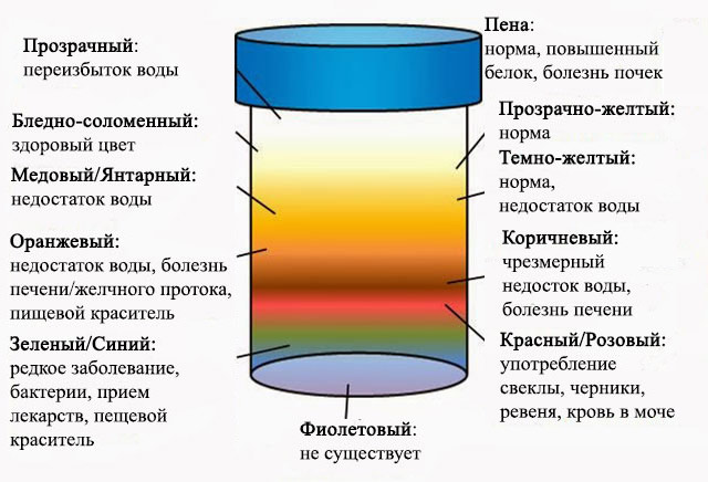 Почему меняется окраска мочи Какого цвета должна быть моча в норме и при патологиях