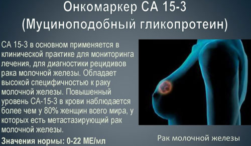 Наличие в крови онкомаркера СА 15-3 При каких заболеваниях повышен онкомаркер СА 15-3