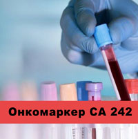 Значение, расшифровка и нормы онкомаркера СА 242