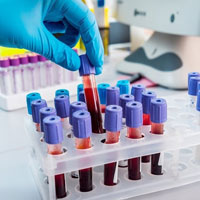 Что показывает анализ на антиген плоскоклеточной карциномы (SCC)