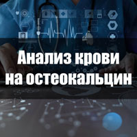 Когда назначают анализ остеокальцин. Норма в результатах и причины отклонений.