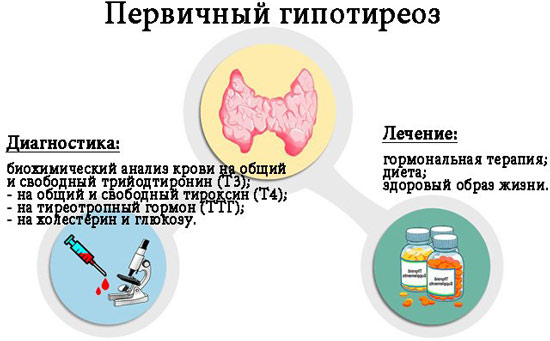 Первичный гипотиреоз Диагностика при первичном гипотиреозе