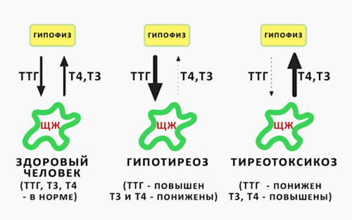 Когда уровень трийодтиронина свободного понижен? Норма и отклонения трийодтиронина