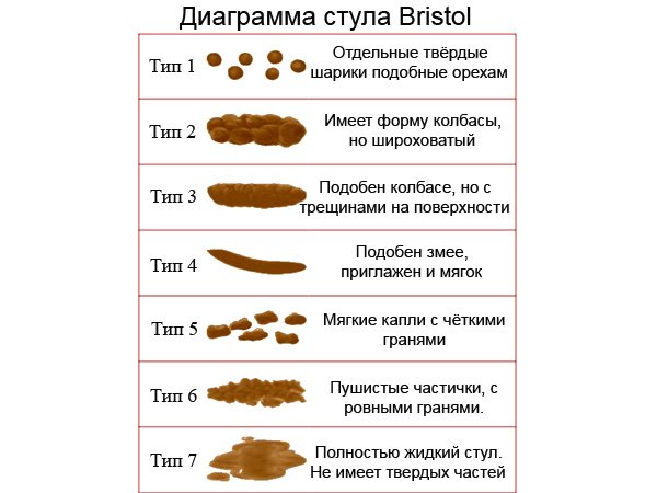 Диаграмма стула Типы стула