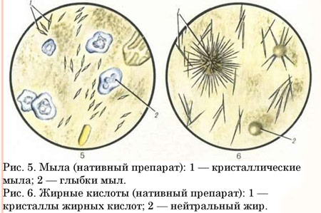 Появление жирных кислот в анализе кала Как выглядит появление жирных кислот в каловой массе