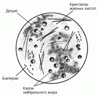 Причины и разновидности появления жирных кислот в кале
