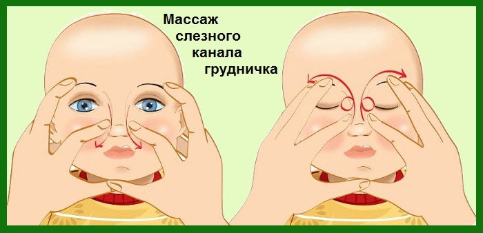 Массаж слезного канала у мледенцев 6