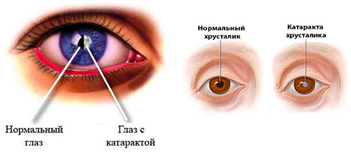 Болезни 3