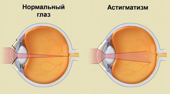 аст 4
