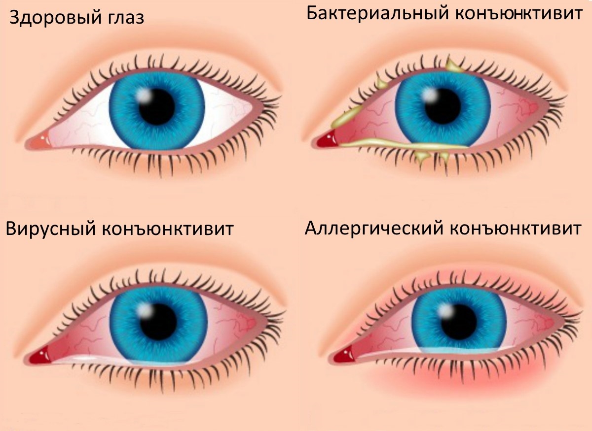 капли 4